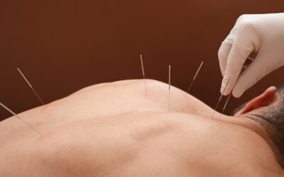 Theories of acupuncture  