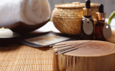 Why acupuncture can be a powerful part of your care